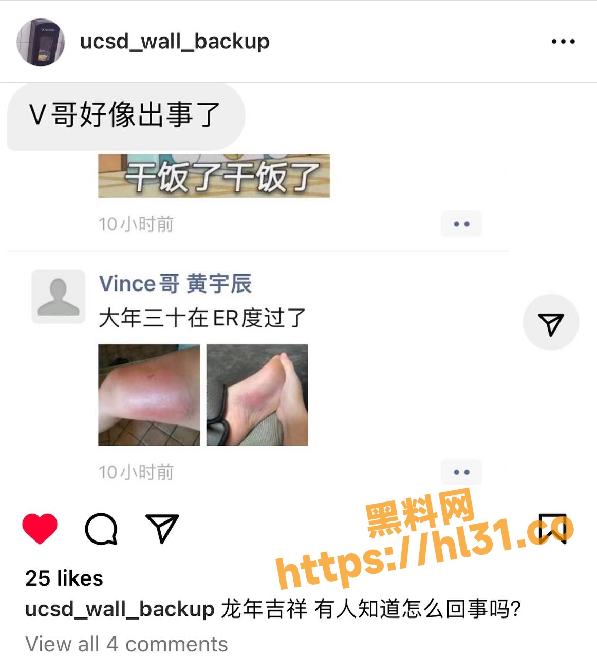 UCSD 人体改造 Vince哥 大年三十住进夏威夷岛的ER！原因是他为了抢在结婚前最后再玩一次！