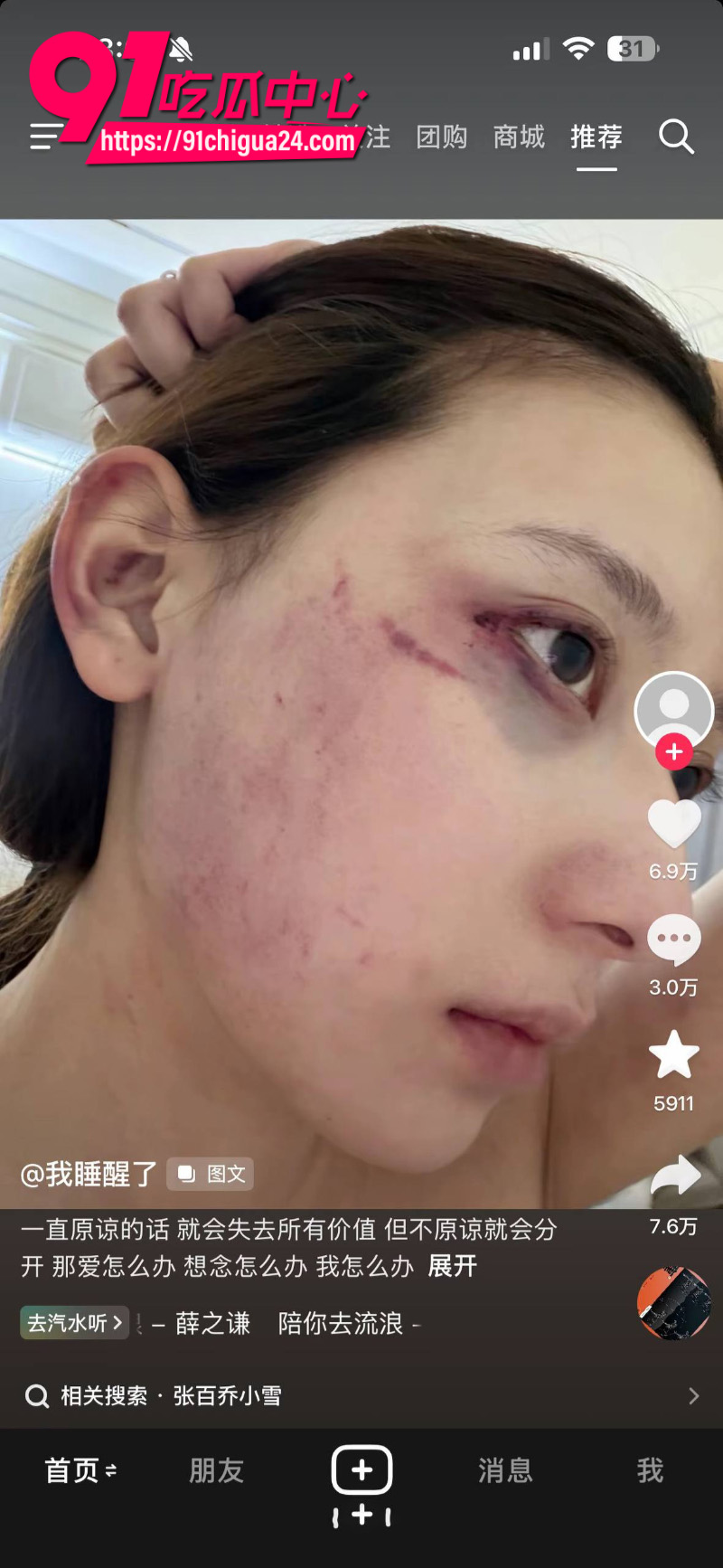 千万大V张百乔家暴老婆视频流出老婆迅速网上辟谣20