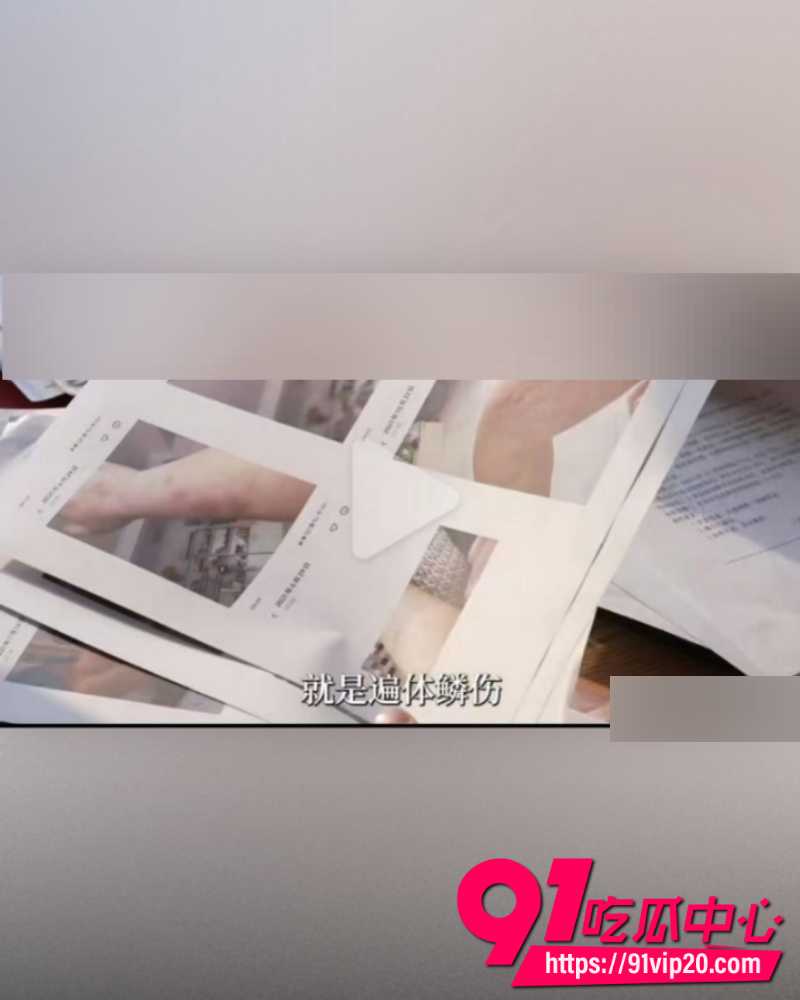 湖北恩施商文娟家暴案一审 7 湖北恩施商文娟家暴案一审 7
