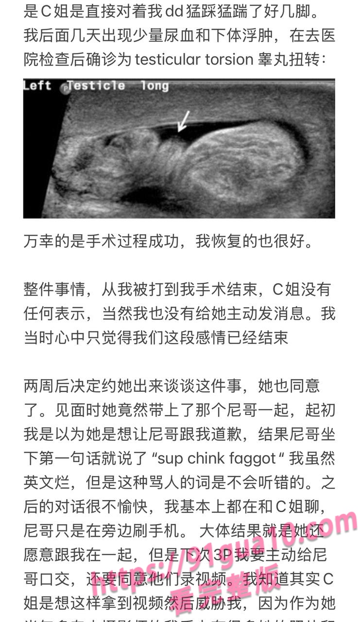 媚黑婊Caroline8 媚黑婊Caroline8