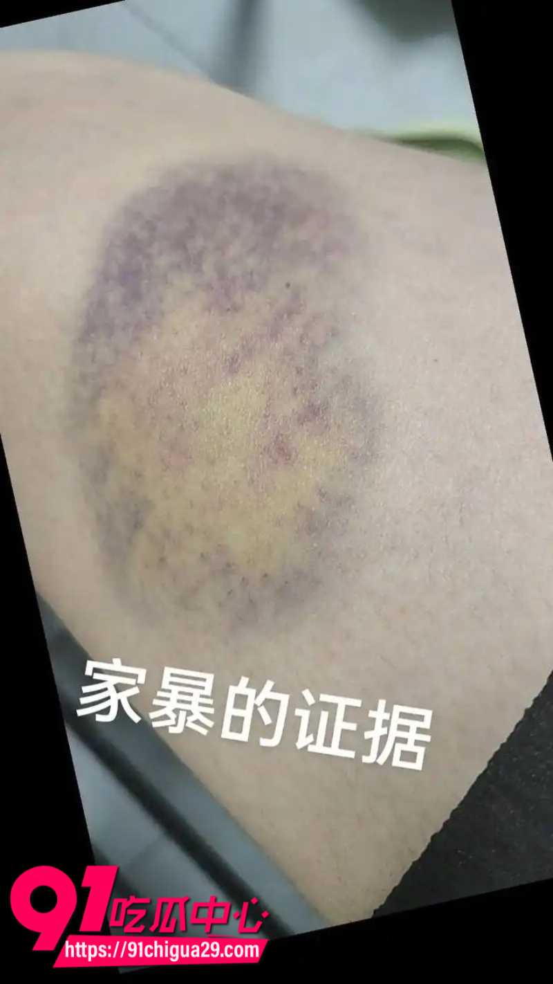 前国脚孙吉被妻子江梦蝶实名举报骗婚骗财家暴出轨19