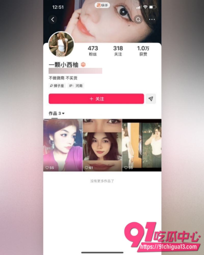 温州医科巴基斯坦留学生乐阳  21