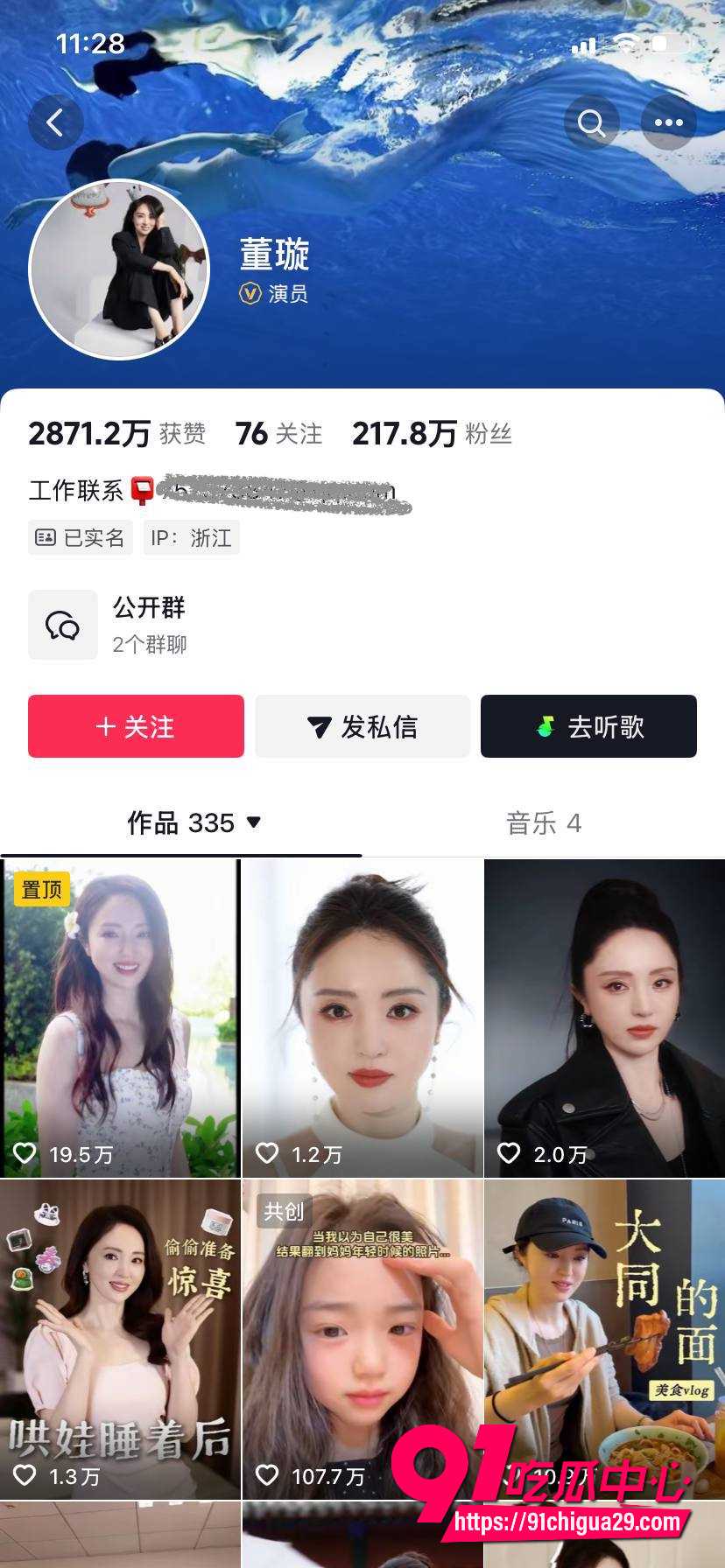 娱乐圈大瓜 张婉婷自爆给高云翔当小三怀孕被逼打掉 宋宁峰出轨后劝小三退让瓜太抓马了!