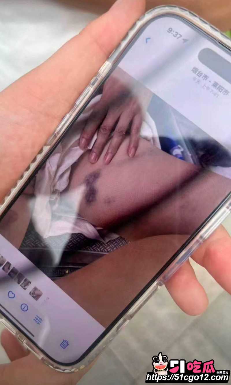 山东烟台莱阳幼儿园打人事件014