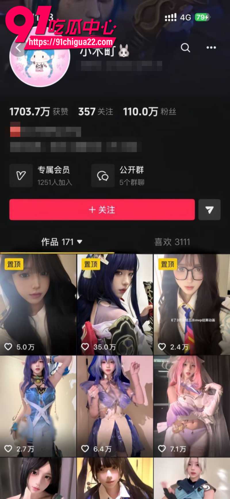 抖音110W粉丝女网红小木町 高价定制福利 小母狗身穿吊带丝袜上演淫荡私密大秀
