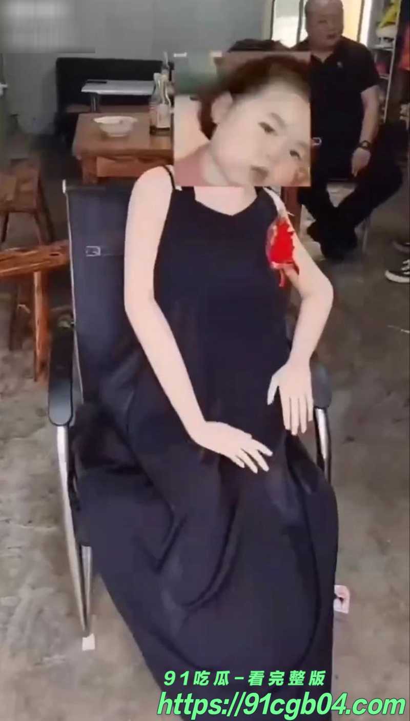 72